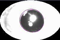 Normal Eye Preview